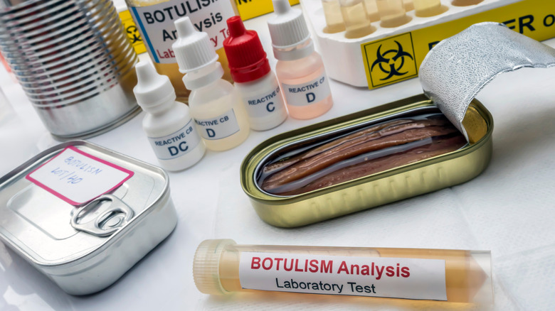 Botulism lab test