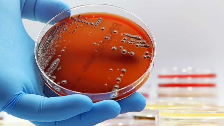 salmonella growing in a lab